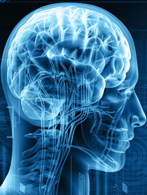 Neurochirurgie